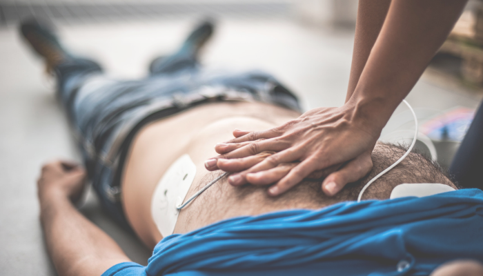 Do We Need to Train Employees to Use Workplace Defibrillators?